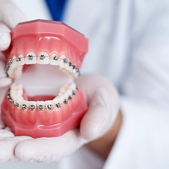 a model of braces