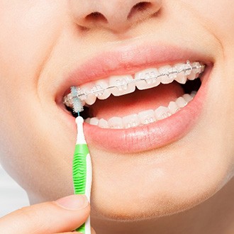 Woman using interproximal brush to clean between their braces