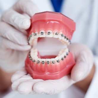 Grafton orthodontist holding model of teeth with braces