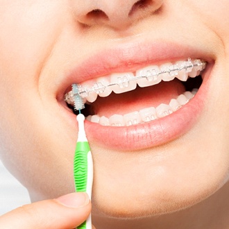 Woman using special brush to clean braces