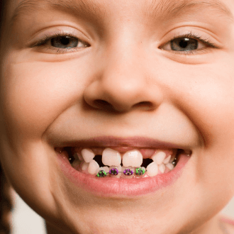 Child with pediatric orthodontics smiling