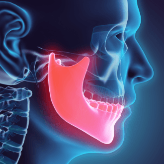 3 D rendering of jaw and skull structure before dentofacial orthopedics