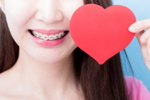 Closeup of patient with paper heart ready for kissing with braces