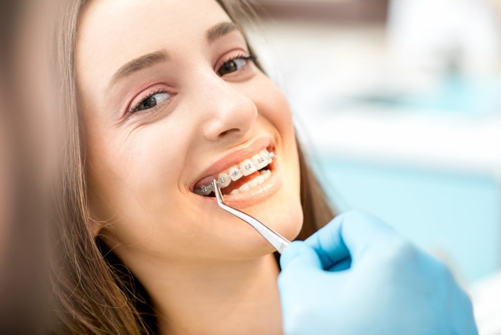 Closeup of woman with braces smiling at orthodontist's office