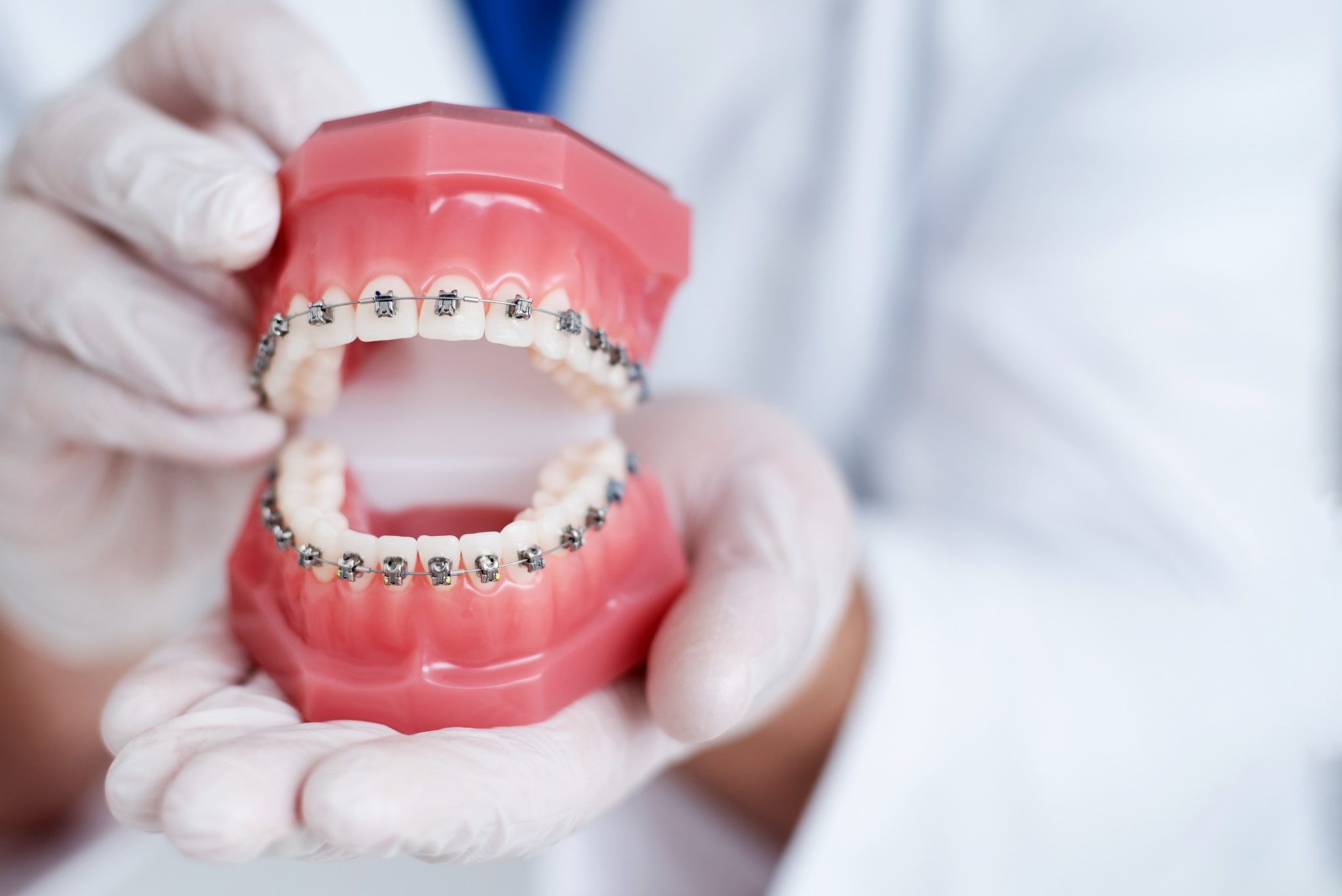 The History of Braces l Simply Orthodontics Grafton