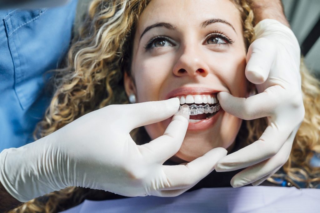 Dentist removing patient’s Invisalign tray